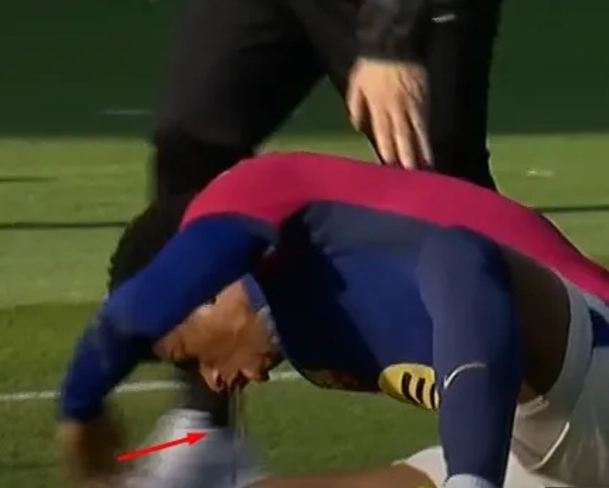 Ngôi sao Barca nôn ra máu ở trận thua Las Palmas 1 sao barca non ra mau o tran thua las palmas