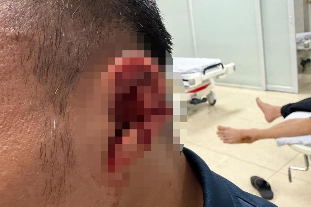 Trọng Hoàng bị Hoàng Hên giẫm rách gần đứt lìa tai trái 1 Trong Hoang 2