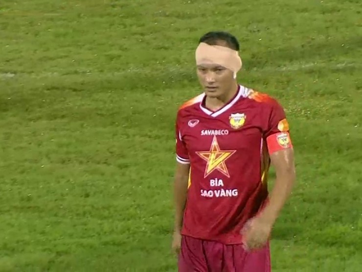 Trọng Hoàng bị Hoàng Hên giẫm rách gần đứt lìa tai trái 3 hoang daidien 1761927015 858 width740height495 anh cat 4 3