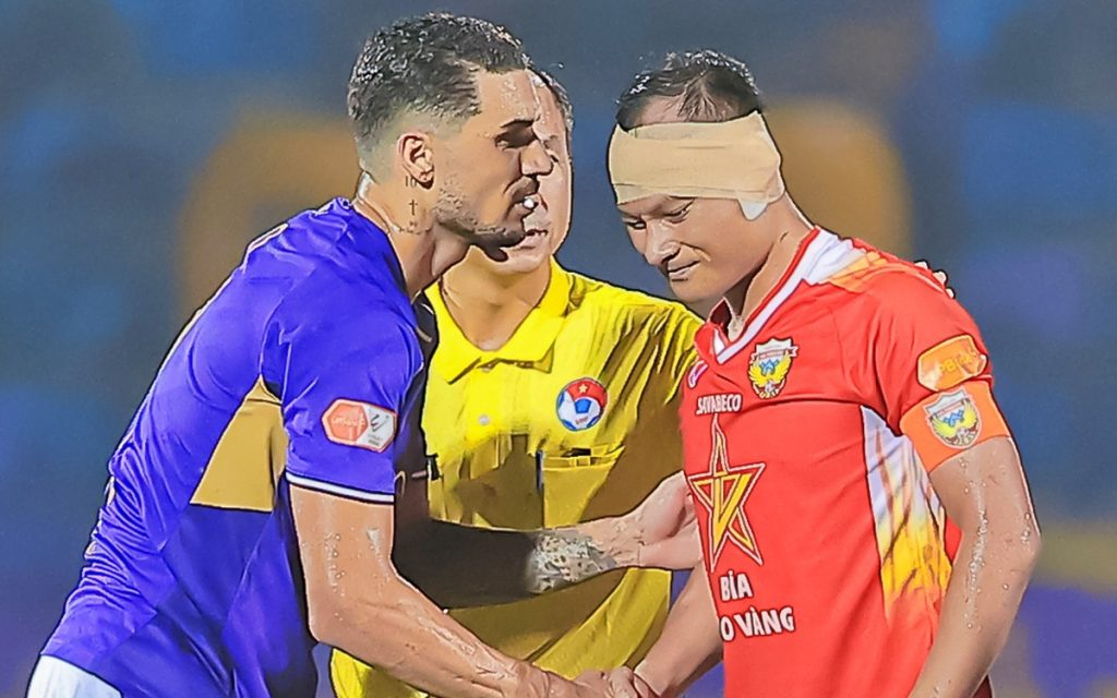 Trọng Hoàng bị Hoàng Hên giẫm rách gần đứt lìa tai trái 2 trong hoang do hoang hen 17619317467691932184667 27 318 701 1396 crop 1761931815279485887216